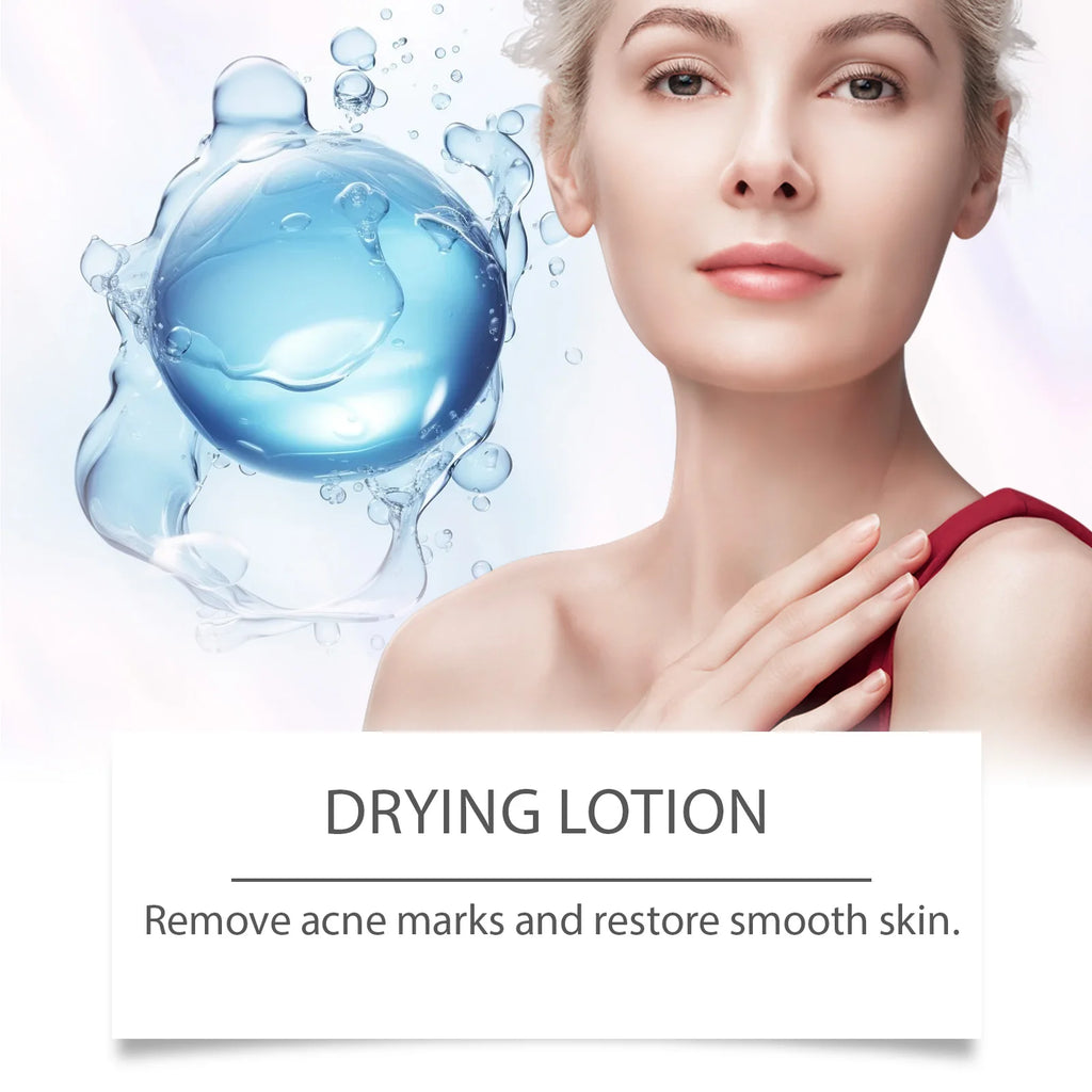 Salicylic Acid Drying Lotion — Acne, Pores & Scar Renewal