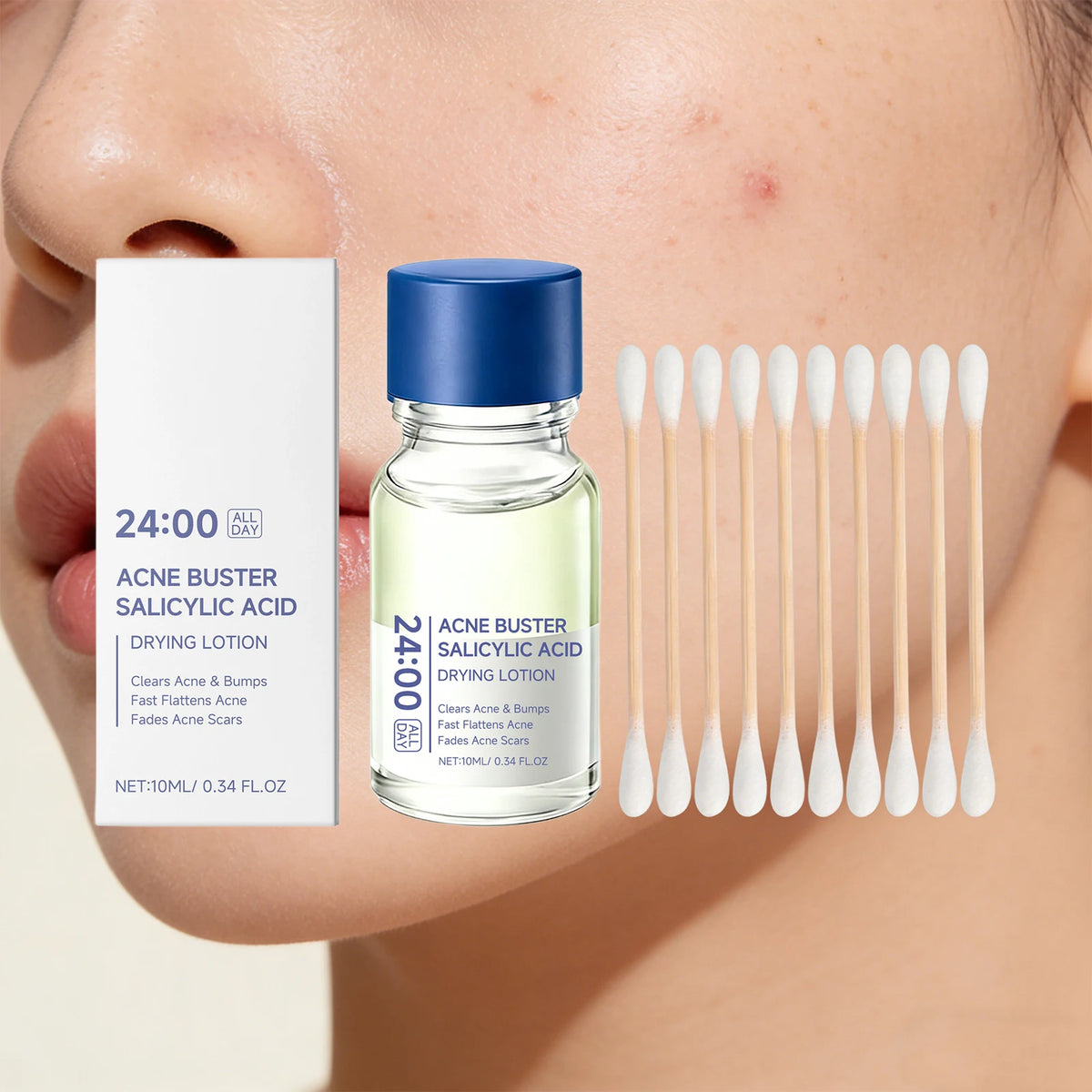 Salicylic Acid Drying Lotion — Acne, Pores & Scar Renewal