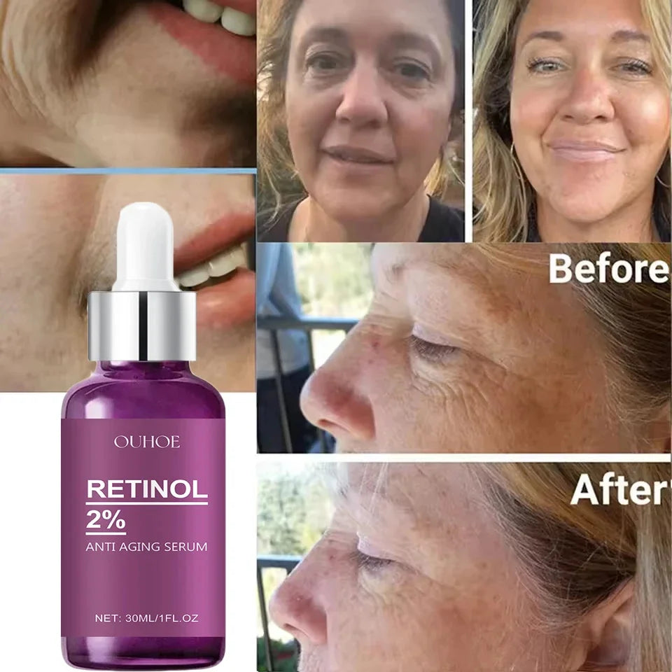 Retinol Anti-Aging Face Serum