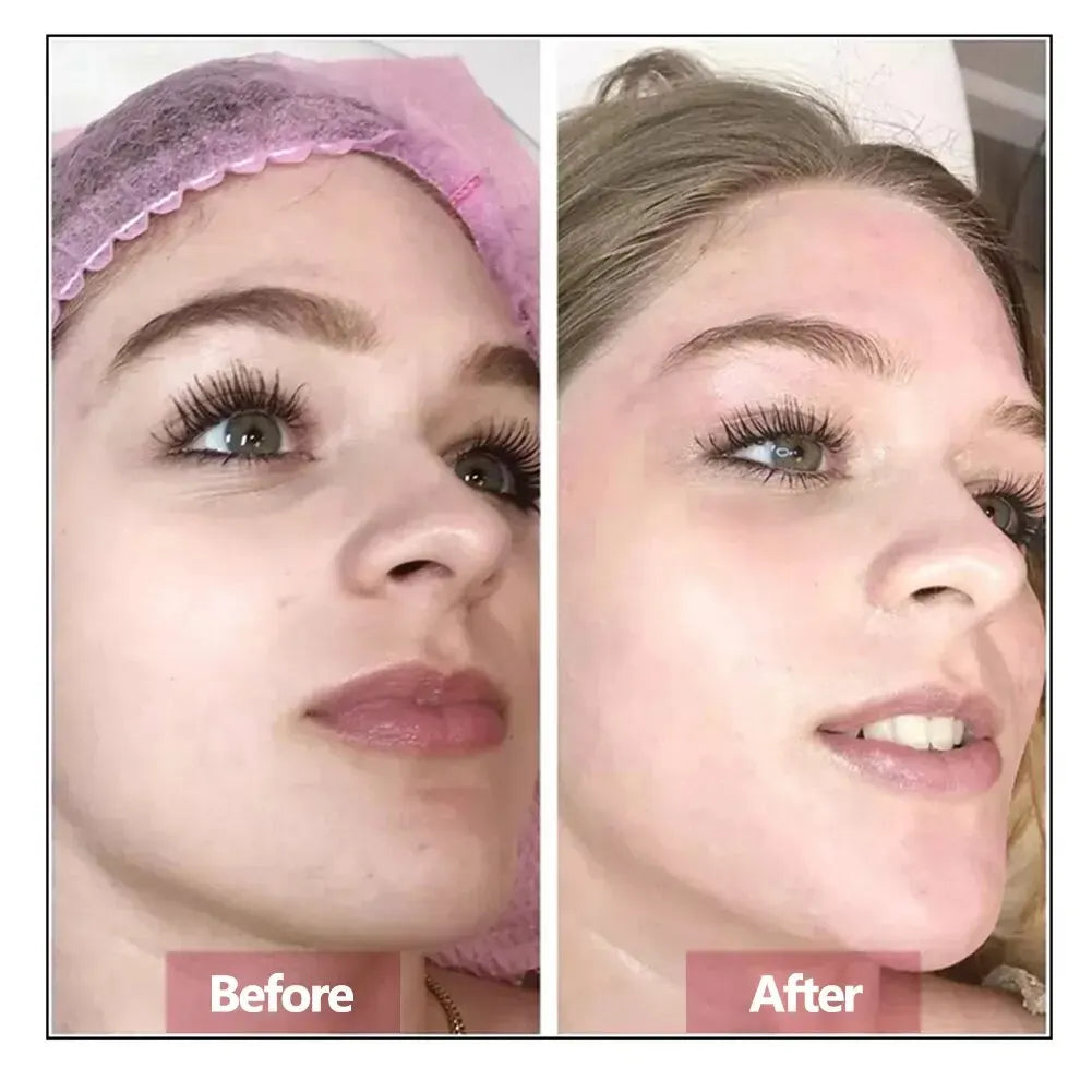 Hyaluronic Acid Face Serum — Firming, Moisturizing & Anti-Aging