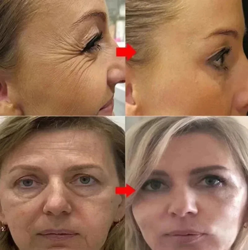 Retinol Anti-Aging Face Serum