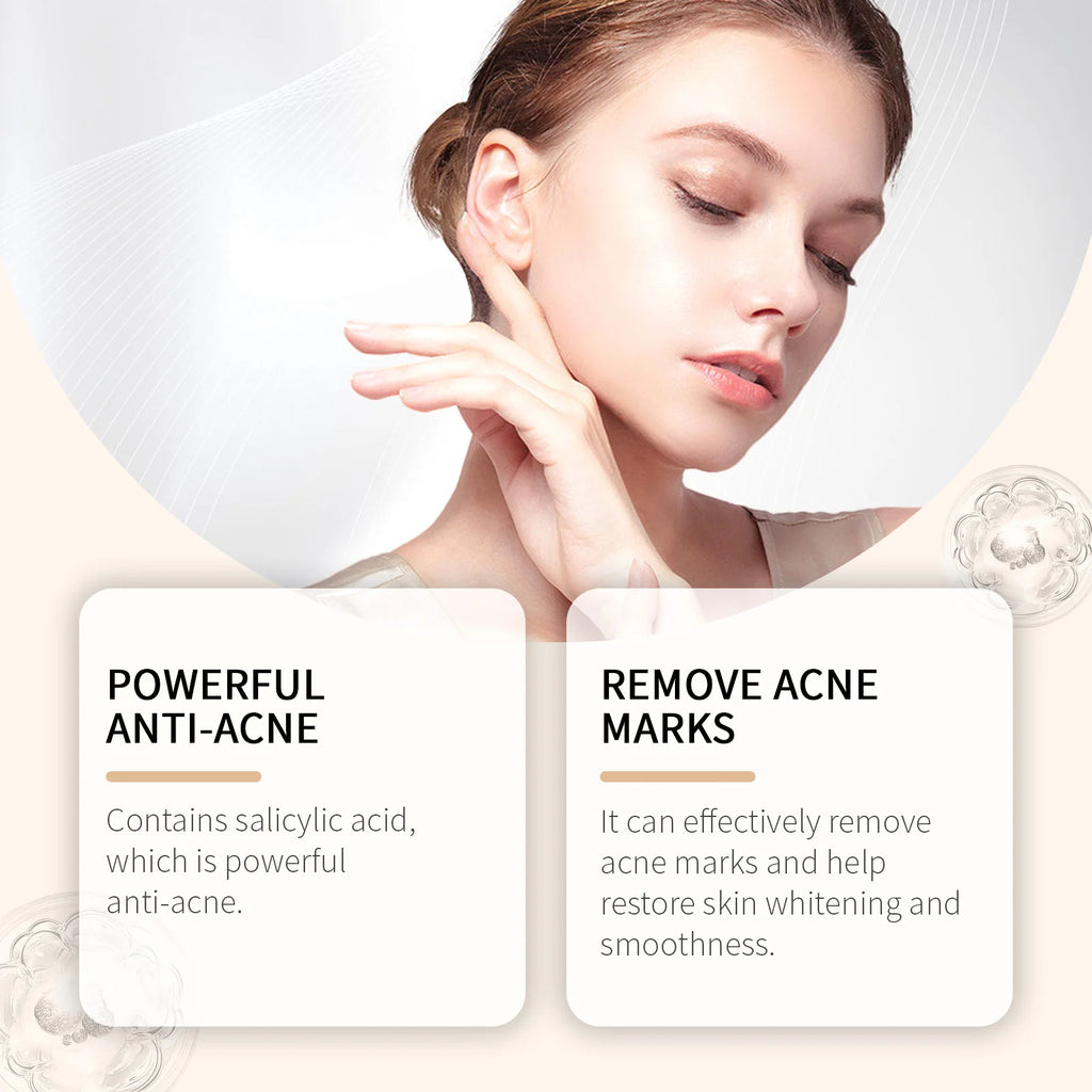 Salicylic Acid Drying Lotion — Acne, Pores & Scar Renewal