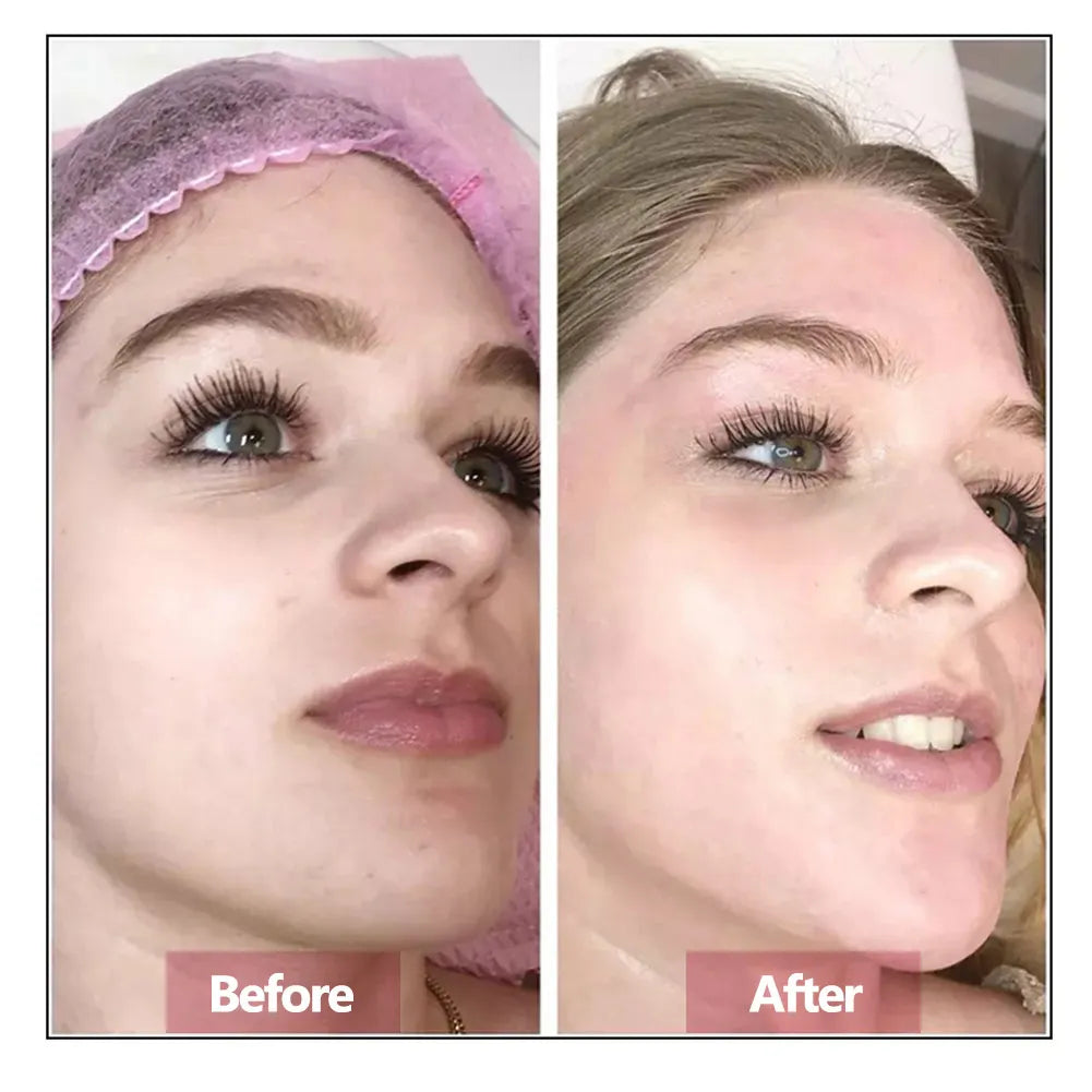 Hyaluronic Acid Face Serum — Firming, Moisturizing & Anti-Aging