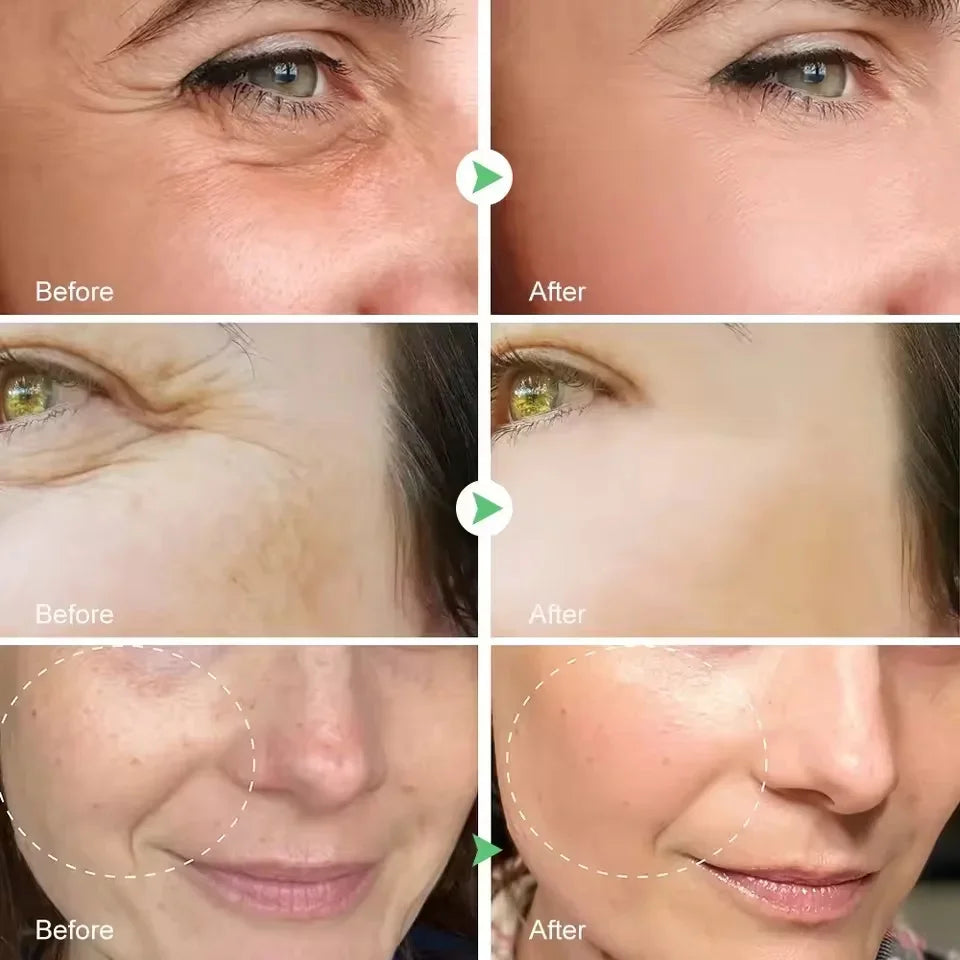 Retinol Anti-Aging Face Serum